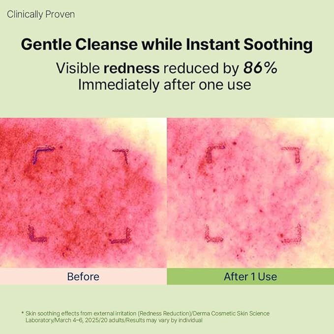 HYCICA Soothing Gentle Cleansing Foam | Low pH 5.5 Cleanser for Sensitive Skin, Calming Hydrating Cica Face Wash & Barrier Care, Centella, Ultra-Low Molecular HA, Korean Skincare, 5.07 fl oz