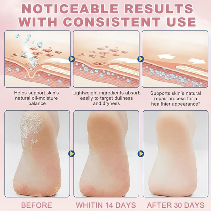 60% Urea Cream plus 2% Salicylic Acid - Upgraded Urea Foot Hand Cream Stick for Repairing Restore Balm, Cracked Hands Elbows Feet Knees, Moisturizes and Hydrates the Dry & Dead Skin, Peach Scent