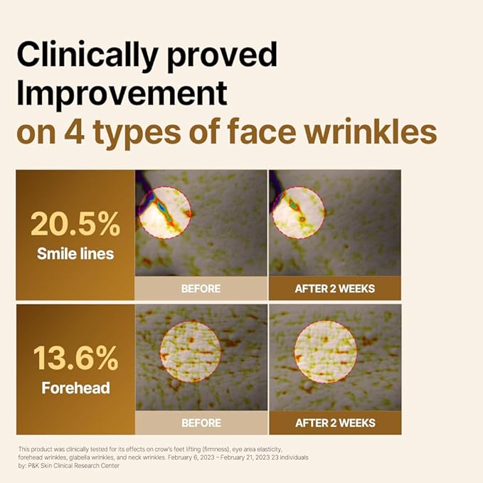 ISOI Intensive Lifting Gua Sha Ampoule Stick, Eye Roller, Under Eye Serum for Dark Circles, Puffy Bags, and Wrinkles with Bulgarian Rose Oil & Peptide Complex, Korean Skin Care (0.5 fl.oz, 15ml)