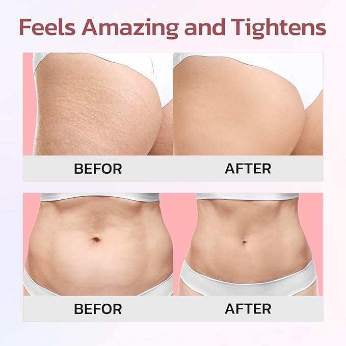 Cellulite Cream, Butt Firming and Lifting Cream - Reduce Cellulite Appearance | Reduce Loose & Stretch Mark Skin Tightening Cream for Body Booty, Legs & Belly Enhances Curves 3.72 fl.oz