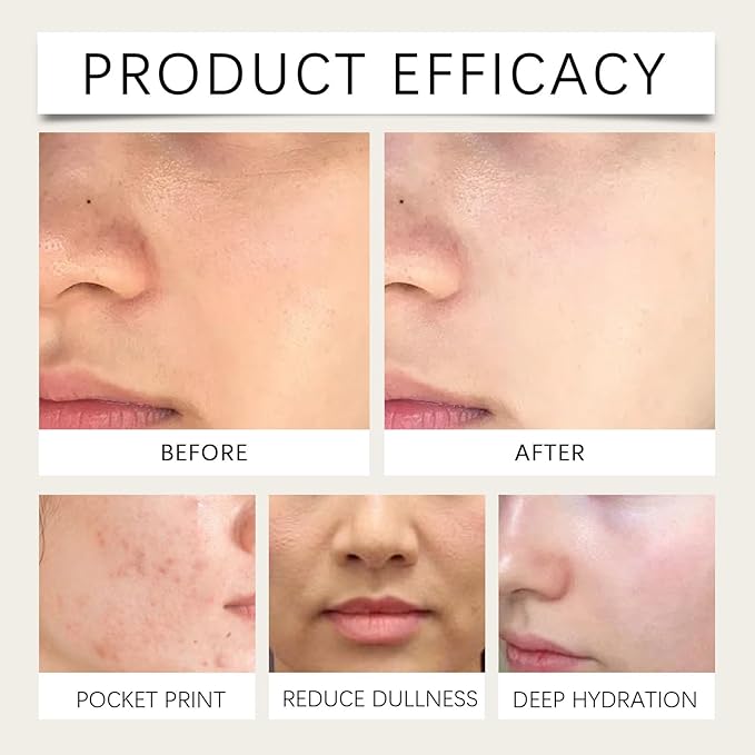 Milk Toner, Hydrating Toner for Face, Soothes Skin, Locks in Moisture, Reduces Redness, Barrier Repair, Pore Tightening, Fit for Sensitive & Oily Skin-150mL /3.38 Fl.Oz