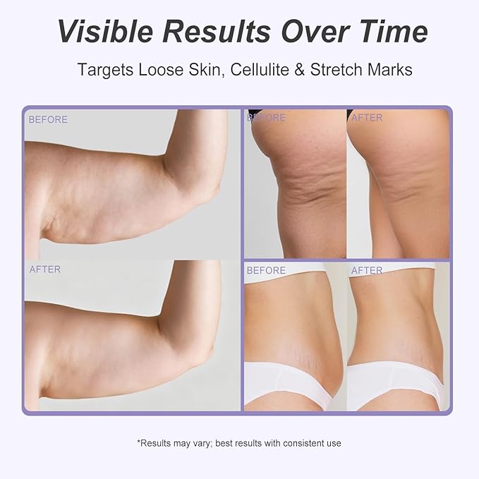 Dreamy Glow Overnight Toning Whip Cream – Anti Cellulite & Tightening Loose Skin for Body – LIFTONIN® Get Firming Cream with Satin Eye Mask 3.38 fl oz