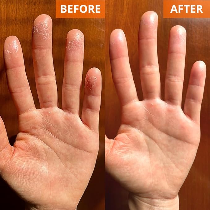 Yu-Be Moisturizing Skin Cream 4.4 Fl. Oz. Jar I Deeply Hydrating Non-Greasy Moisturizer for Severely Dry Skin I Soothing Camphor Calms, Cools, & Relieves Skin I Vitamins Repair & Nourish