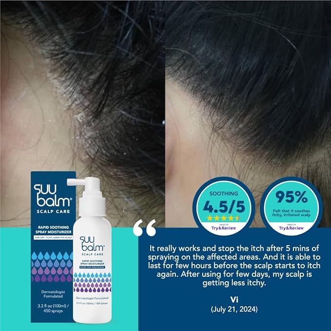 Suu Balm Dry Scalp Treatment, Rapid Itch Relief Anti-Dandruff Scalp Spray Moisturizer, Cooling Itchy Scalp Treatment for Flaky Sensitive & Psoriasis, Cooling Menthol & 5 Ceramides, 1.35 fl oz