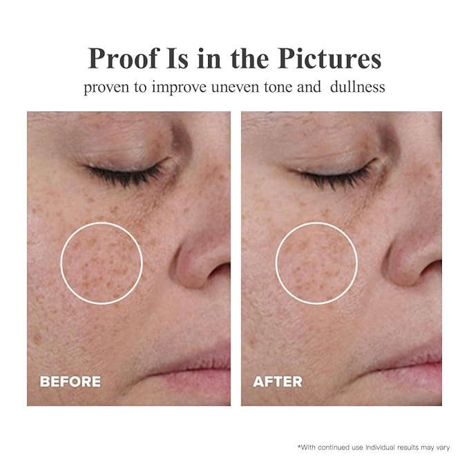 HKH Triple Vitamin C Dark Spots Correction Capsules Serum For Face,Camellia VE Anti-Aging Essence For Women Camellia Niacinamide serum For Women To Tighten Sagging Skin And Reduce Fine Lines