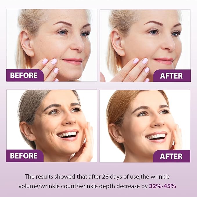 Venature Bakuchiol Retinol Rejuvenation Serum,2024 Best Retinol Serum for Wrinkles Bakuchiol Retinol Face Serum Korean, Retinol Serum for Wrinkles, Reduce Wrinkles(2pcs)