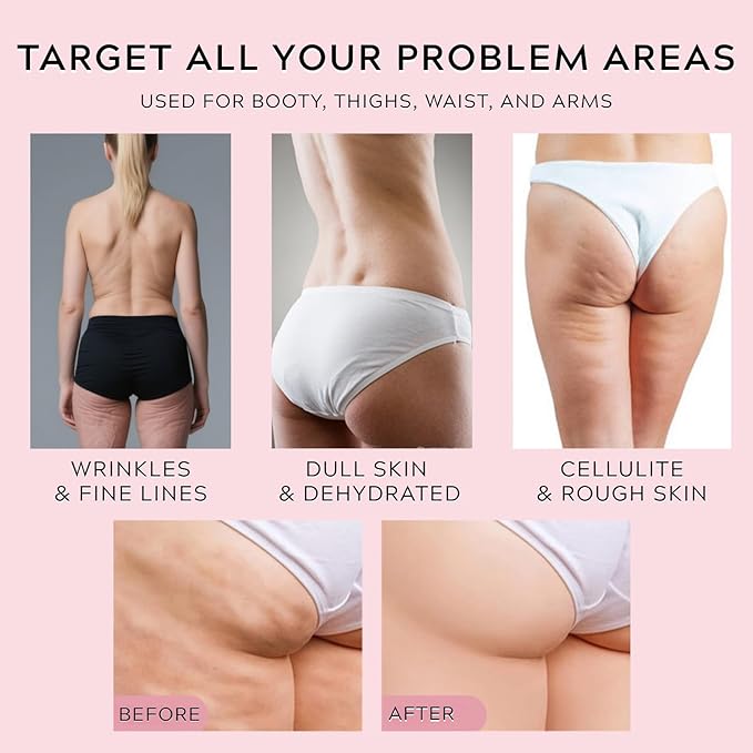 Butt Tight Lift Cream - Cellulite Cream Visibly Firm and Smooth Skin, Reduces the Appearance of Cellulite, Lift & Firm Moisturizing, Reduce Loose and Crepey Skin 100 ml