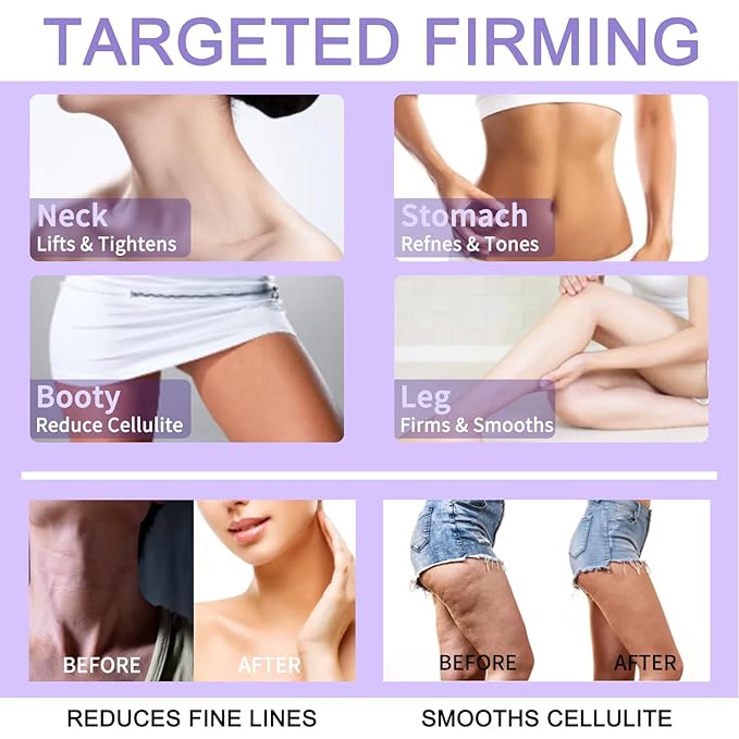 Overnight Toning Whip, Body Firming Cream for Cellulite & Loose Skin - Tightening Cream for Stomach Thighs Butt, Post-Weight Loss Treatment with Caffeine & Retinol | Fast-Acting & Non-Greasy (02)