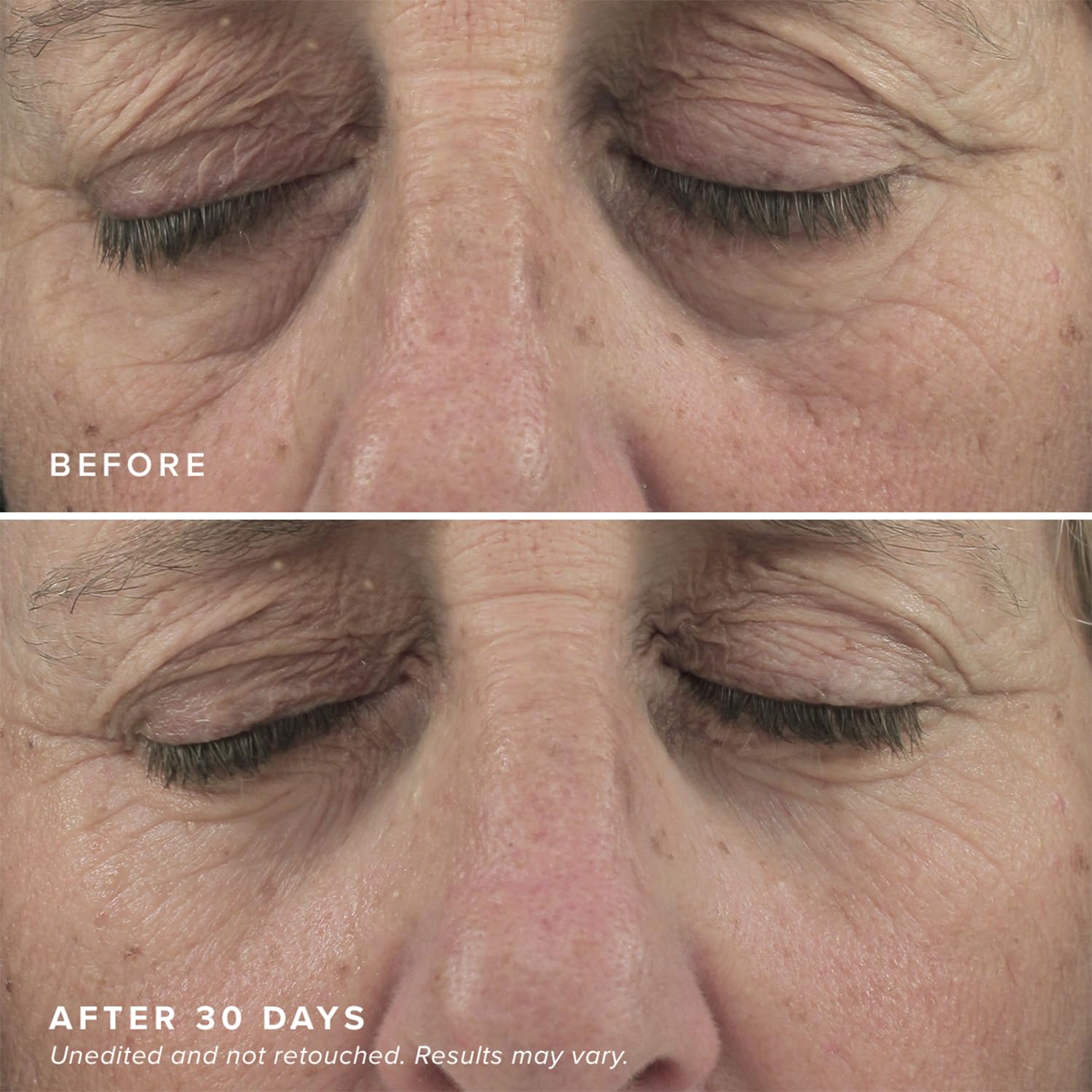 Brightening Eye Masks (30 Pairs) - Caffeine Eye Masks for Dark Circles and Puffiness with Hyaluronic Acid, Eye Patches for Puffy Eyes