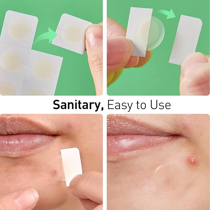 Pimple Patches, 15 mm Invisible Acne Patches for Face with Salicylic Acid, 0.01cm Extra Thin Outer Edge, Hydrocolloid Zit Patch for Pustule, Whitehead, Cystic Acne Spot, 48 Count