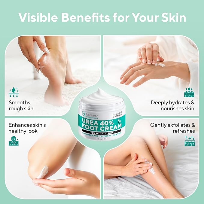 Lavinso Urea Cream 40 Percent for Feet with Maximum Strength - Foot Cream for Calluses and Dry Cracked Heels - Rough Skin Repair for Men and Women