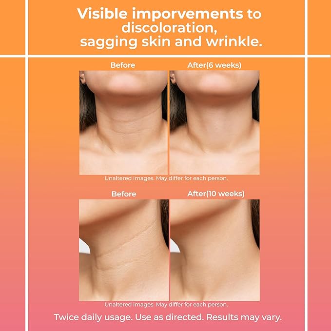 Neck Cream for Tightening and Firming: Anti Aging Anti Wrinkles Reduces Neck Lines Fine Lines - Retinol Niacinamide Squalane Hyaluronic Acid Ceramides Cruelty Free Paraben Free 2.8 OZ/80g