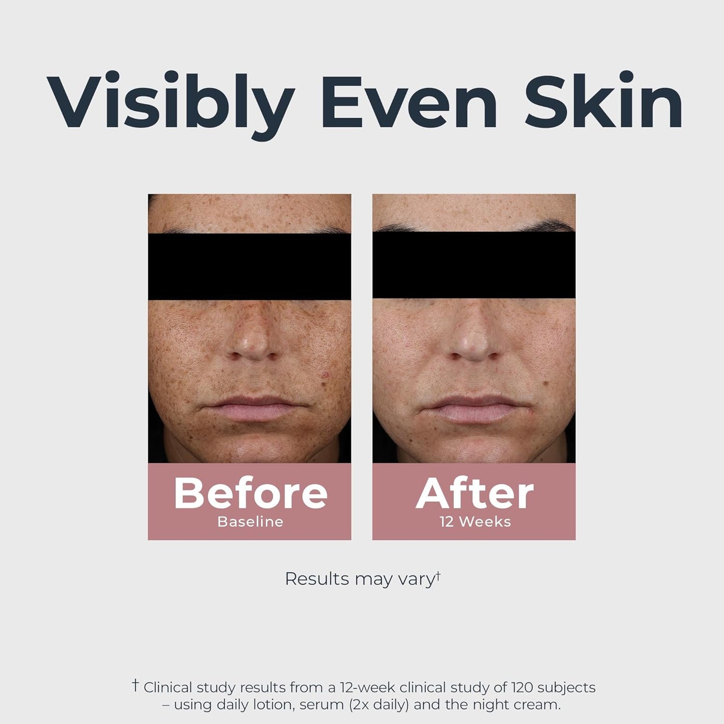 Radiant Tone Dual Serum – Dark Spot Corrector, 1 oz ✨🌿