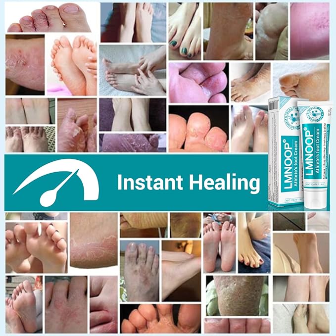 Athletes Foot Treatment Cream, Maximum Strength for Athlete's Foot (Tinea Pedis), Itching, Blister, Burning, Cracking, Scaling, Beriberi,Natural Herbs Antifungal Foot Cream (2-Pack)