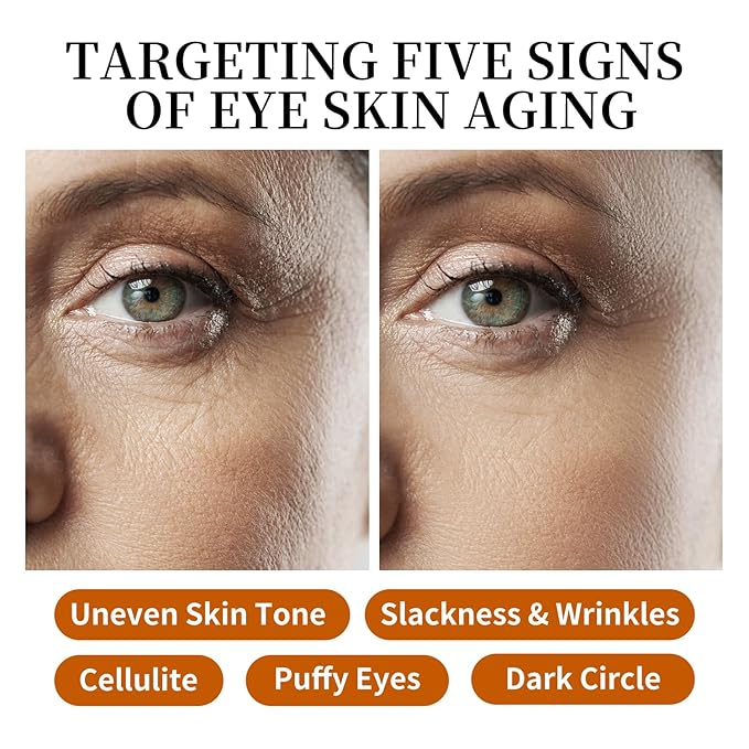 Retinol Vitamin C Eye Cream & Serum Set for Anti-Aging Treatment - Gentle Formula for Sensitive Skin (30g/1 OZ and 8ml/0.27 OZ)