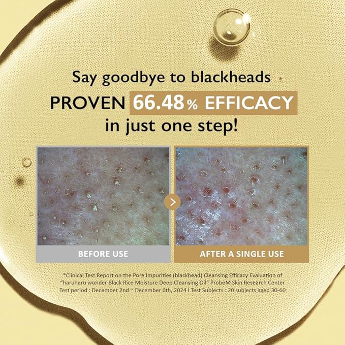 HARUHARU wonder Black Rice Moisture Cleansing Oil, 5.1 fl oz, Double Cleansing, Daily Makeup remover, Pore Oil Cleanser, Korean Skincare for sensitive, normal and Oily Skin