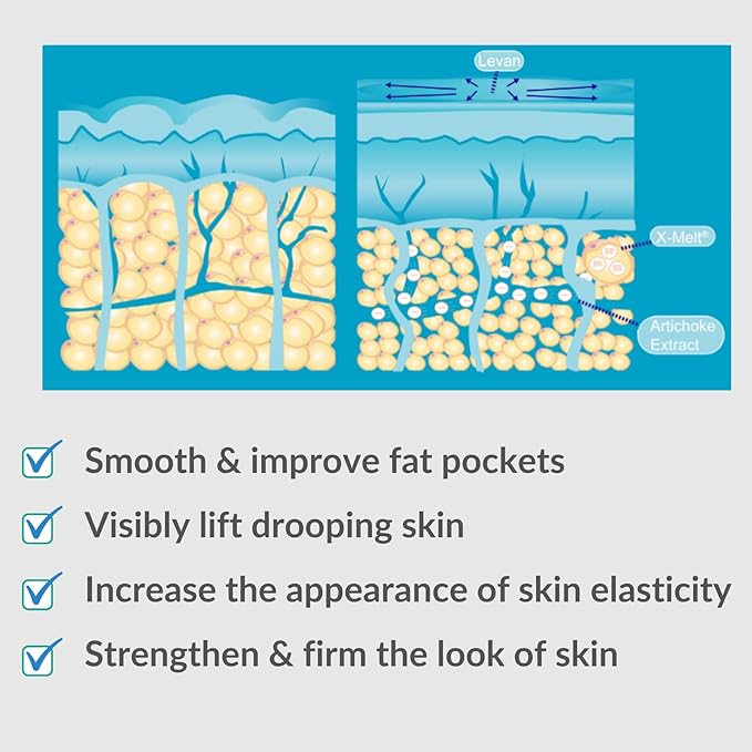 Serious Skincare Anti-Cellulite Cryo-Cinq Cold Sculpting Body Cream - Skin Firming, Tightening for Stretch Marks, Legs, Arms, Buttock - Caffeine Body Moisturizer - Rollerball Applicator - 8 oz.