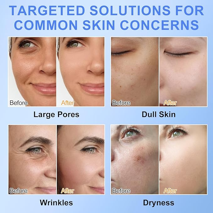 Collagen Face Mask,Firming Collagen Mask with Collagen Peptides for Anti-Aging, Facial Hydrogel Masks with low molecular weight collagen for elasticity and moisturizing