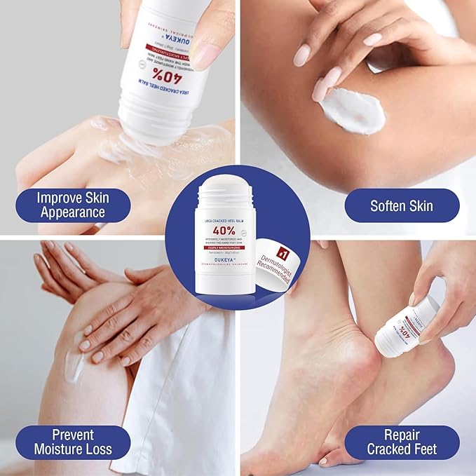OUKEYA Urea Cream Stick 40 Percent,Heel Balm,Urea Hand Cream Stick and Foot Cream Stick for Dry Cracked,Cracked Heel Treatment.Urea Cream 40 Percent for Feet Maximum Strength（2 Pack）
