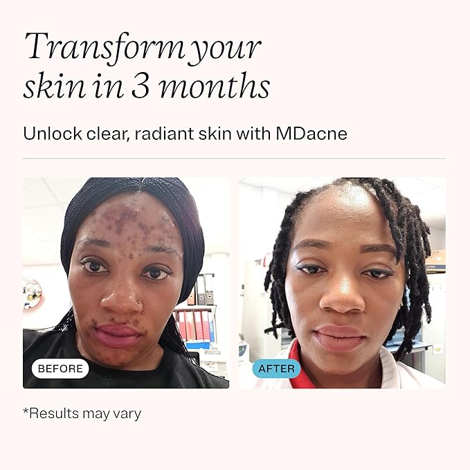 MDacne 3 Step Retinol Acne Kit - Retinol Cream 0.25%, Salicylic Acid Cleanser, Niacinamide Moisturizer - Plant-Based kit for Hormonal Acne, Blemishes, Wrinkles, 60 Day Acne Kit + Pimple Patch Gift