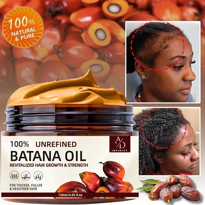 100% Unrefined Raw Batana Oil for Hair Growth Dr. Sebi Organic Pure from Honduras with Keratin, Coffee Extract & Other Ingredients to Enhance Efficacy for Thicker, Strength - Botana Oil 4oz