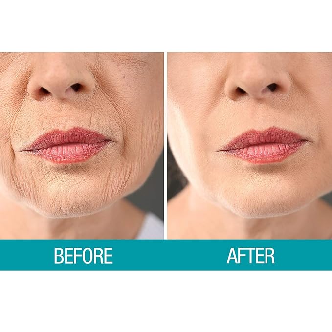 Dermactin Crepe Skin Firming Cream 2.5 oz. (PACK OF 2)