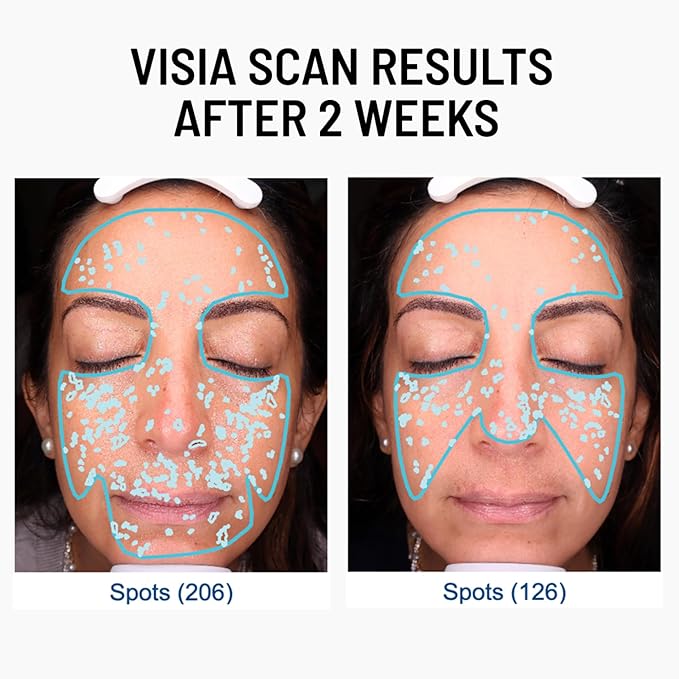 Dr. Brandt Advanced Microdermabrasion Face Exfoliator - Refines Texture, Minimizes the Look of Fine Lines & Enhances Overall Skin Tone - 2 oz