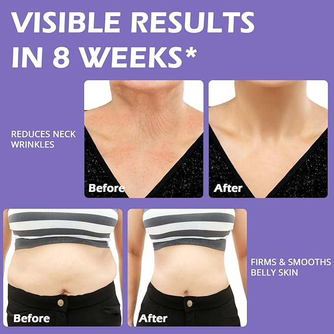 Get Dreamy Overnight Toning Whip,Lightweight Firming Cream,For Women Seeking Smooth, Tightened Skin,Ideal for Legs, Thighs, Belly & Nighttime Use-1 Pack