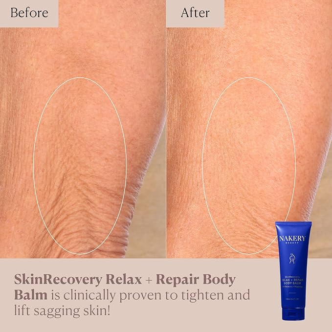 Nakery SkinRecovery Relaxing Magnesium Balm - Skin Tightening Cream for Body with SepiLift & Retinol - Muscle Balm with Melatonin for Restful Sleep - Hydrating Dry Skin Cream with Shea Butter
