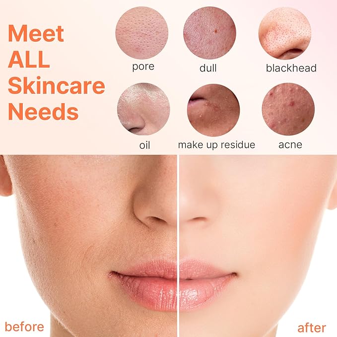 Face Scrubber with 3 Brush Heads & 2 Speeds - Deep Cleaning, Exfoliating, and Massaging for All Skin Types - Facial Cleansing Brush Includes Silicone Head, Travel Case & Free-Plastic Packaging