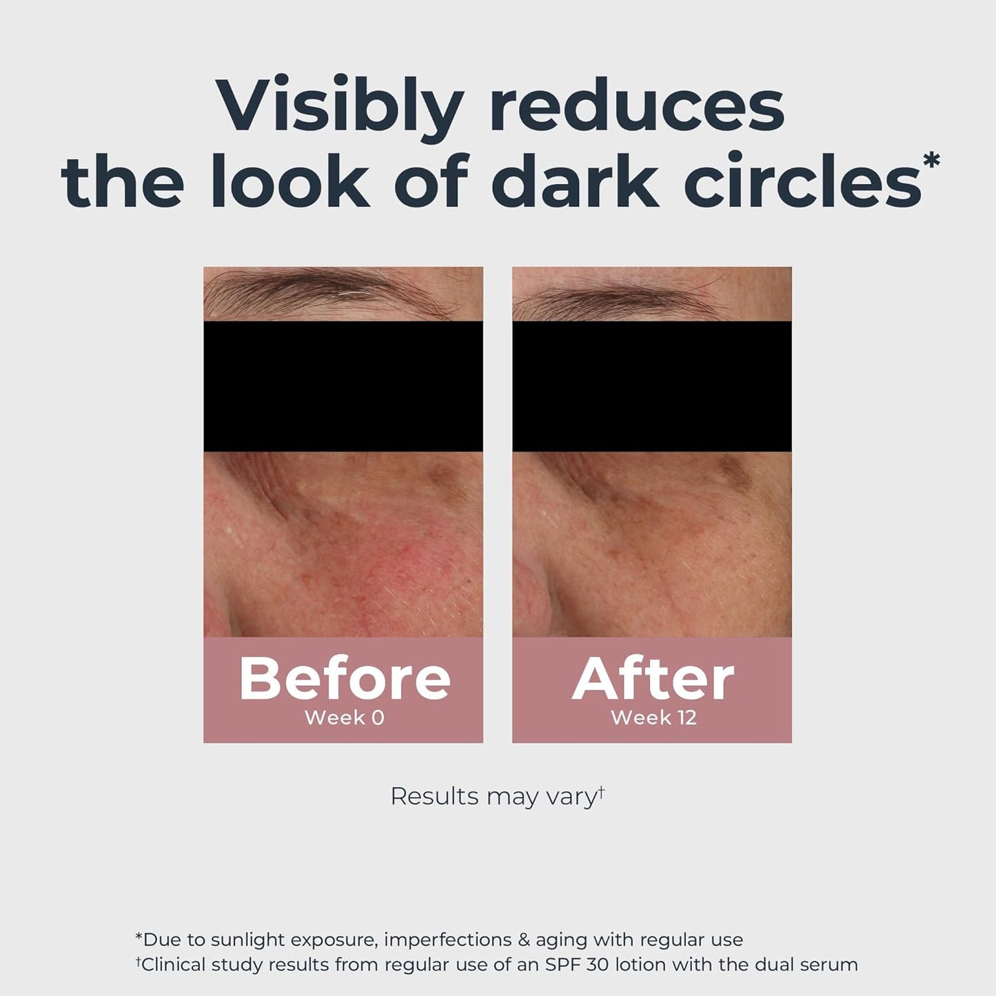 Radiant Tone Eye Cream – Dark Circle Corrector, 0.5 oz 👁️✨