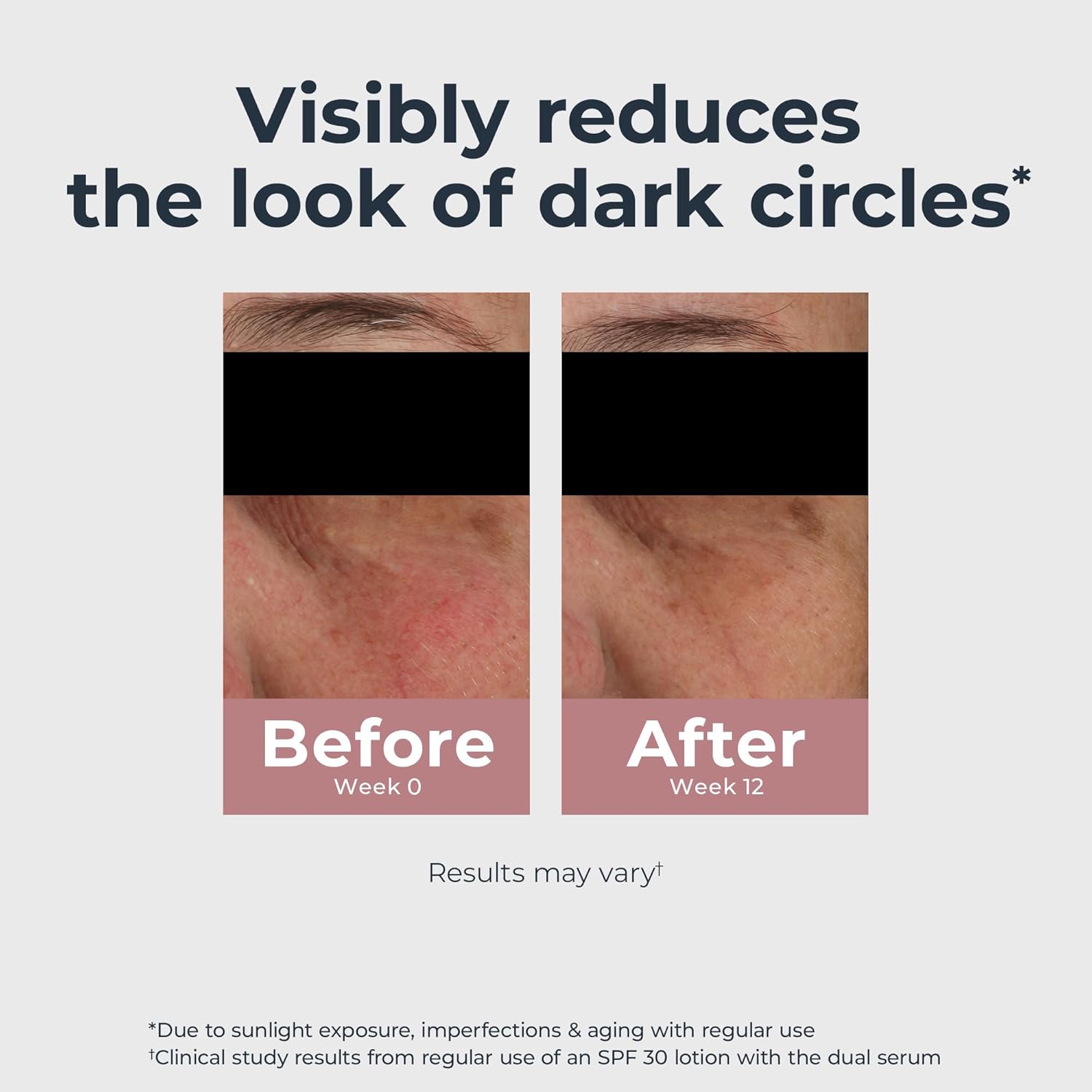 Radiant Tone Eye Cream – Dark Circle Corrector, 0.5 oz 👁️✨