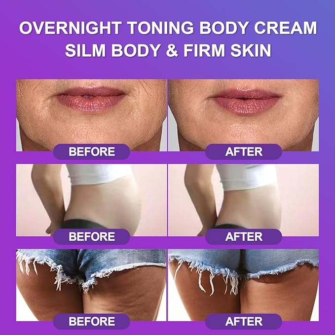 AMRAM Overnight Toning Whip, Skin Tightening, Body Firming Whip That Works While You Sleep, Firming Cream For Loose Skin On The Body(1PCS)