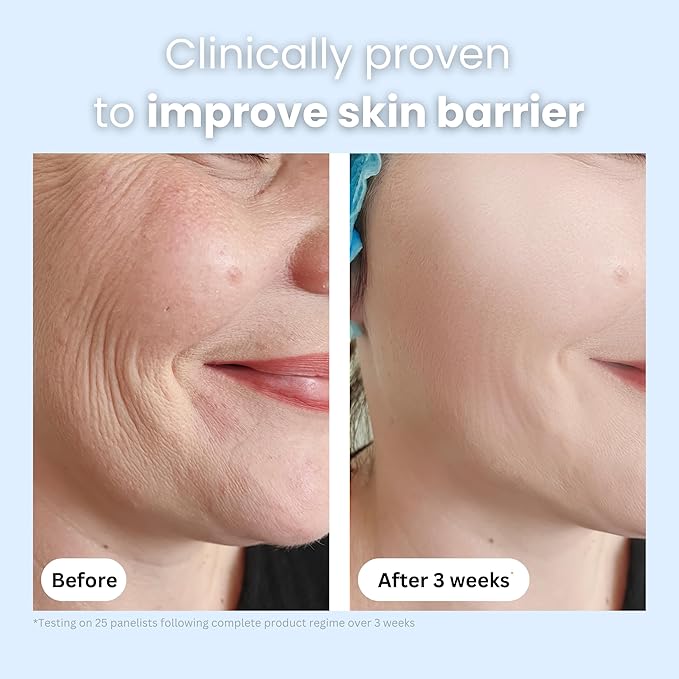 Bee Venom & Manuka Honey Anti-Aging Face Moisturizer | Hydrating, Firming & Collagen Boosting Daily Cream for Men & Women | Natural Manuka Skin Care 2oz