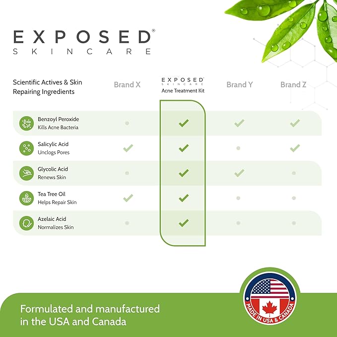 Exposed Skin Care, Basic Acne Treatment Kit with 2.5% Salicylic Acid and 3.5% Benzoyl Peroxide to Clear Up Teen, Adult, Hormonal and Cystic Acne – Natural, Non-toxic and Cruelty Free