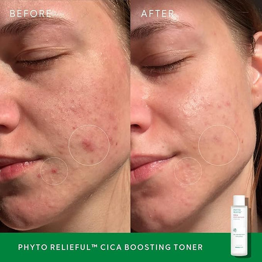 THANKYOU FARMER Phyto Relieful CICA PHA LHA Boosting Toner 7.03 fl oz (200ml), Dermatologist Tested, Alcohol-Free Liquid Exfoliant for Face, Oil-Free Hydrating Toner, Vegan, Fragrance-Free