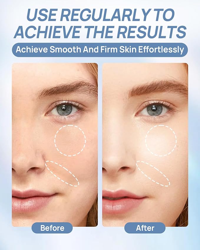 6 Pcs Bio-Collagen Face Mask, Overnight Hydrating Hydrogel Face Masks for All Skin Types - Fine Lines, Elasticity, Pore Minimizing, Firming, Glass Skin Korean Skin Care