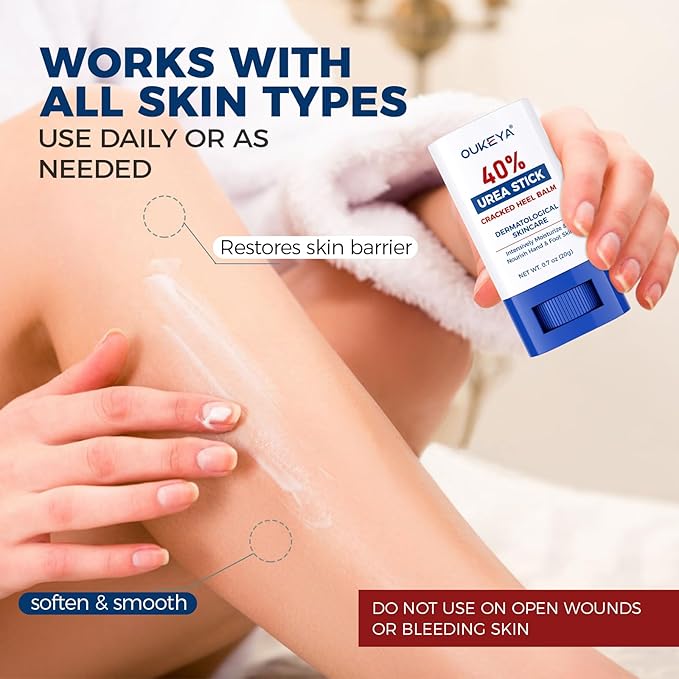 OUKEYA Urea Cream 40 Percent.Urea Cream Stick for Foot and Hand Cream Stick for Dry Cracked, Cracked Heel, Avoid Frostbite, 40 Percent Urea Lotion for Feet Maximum Strength, 2 PACK