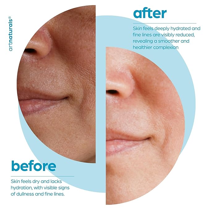 ArtNaturals Hyaluronic Acid Serum - Anti- Aging Facial Serum, Natural Moisturizer w/Vitamin C Serum & Vitamin E - for Skin Care - Reduce Wrinkles & Dark Spots (1 Fl Oz (Pack of 1))