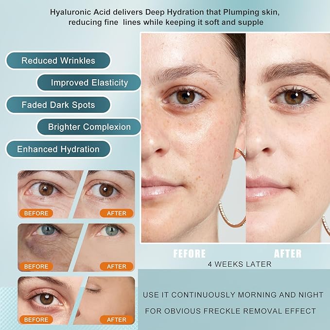 Vitamin C Serum with Hyaluronic Acid - Anti Aging Face Serum for Dark Spot Removal, Wrinkles Reduction, Deep Hydration - Non-Greasy Formula