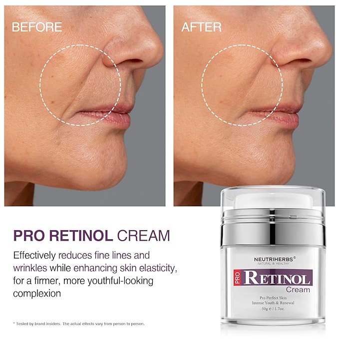 Neutriherbs Retinol Cream for Face,Night Facial Moisturizer Rich Vitamin A,Reduce Fine Lines and Smooth Wrinkles, Anti Aging Skincare - 1.7 fl.oz