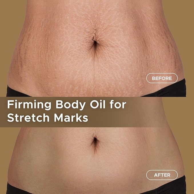 Body Firming Oil for Crepe Skin: Fast Absorbing Firming & Hydrating Skin Care with Jojoba, Grapeseed & Geranium Oils, Vitamin E | 3.4 Fl Oz Moisturizing Treatment Oil for Tightening After Shower