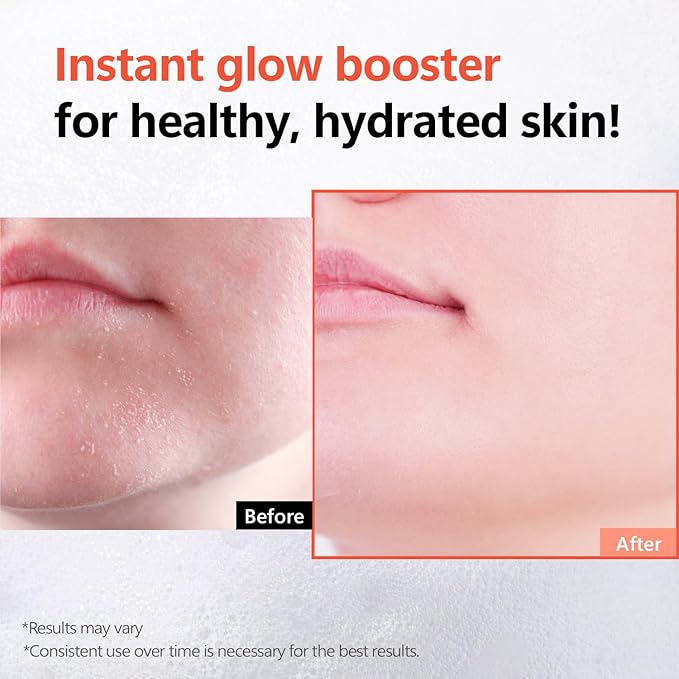 Rice Glow Bubble Toner 5.07 fl oz - Milky Toner for Sensitive and Dry Skin, with Niacinamide and Rice Extract for Deep Hydration, Glowing Skin, Korean Skincare