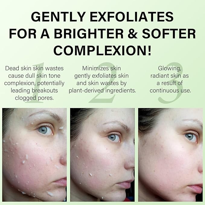 Purifying Exfoliating Peeling Gel Aloe Vera Sparkling Peeling Gel, Deep Cleansing Face Body Scrub Exfoliating Face Wash Facial Scrub Exfoliator Exfoliant Facial, Dead Skin Remover 3.38 FLOZ