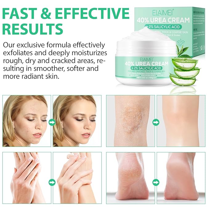 40% Urea Cream for Feet (3.52 oz), Foot Cream for Thick, Cracked, Rough, Dead & Dry Skin, Foot Lotion with 2% Salicylic Acid, Tea Tree , Aloe Vera, Moisturizer For Feet, Elbows, Hands & Knees