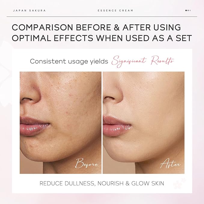 Sakura Skin Care Set, Cherry Blossom Collagen Rejuvenating Facial Kit, Skin Care for Kids & Women with Cleanser, Toner, Serum, Eye Cream, Travel Size Skincare, Nourishing, All Skin Types (9 PCS)