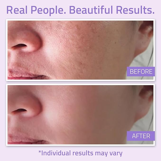 YEOUTH Hydrating Toner for Face Spray with Chamomile and Allantoin, Alcohol Free Refreshing Face Toner for Women and Men 3.4 Oz