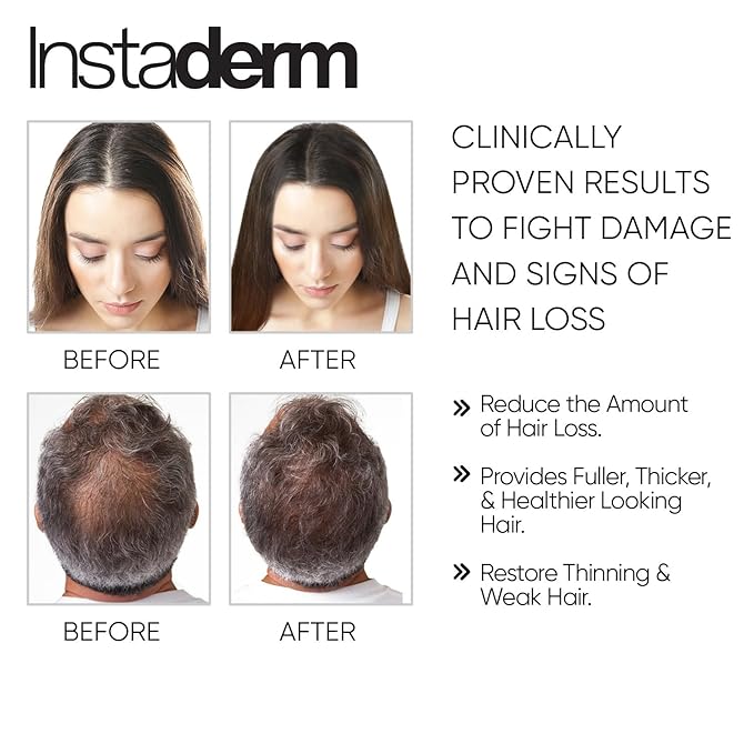 Hair Growth Serum- Extra Strength, DHT Blocker Hair Regrowth & Follicle Restoration Formula Treatment. Promotes Thicker, Fuller, Longer, Healthier Looking Hair for Men & Women.