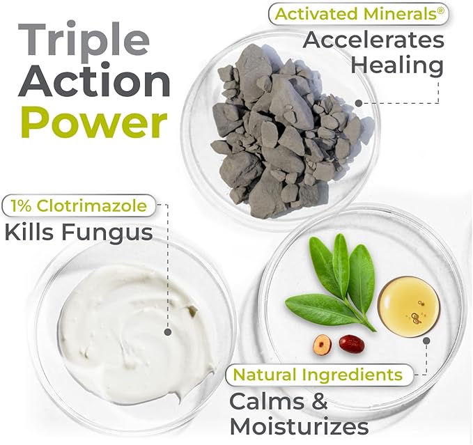 terrasil Athletes Foot Cream with Clinically Proven 1% Clotrimazole, Extra Strength Antifungal Ointment for Treatment of Itchy Feet & Peeling Skin, for Men and Women (1oz)