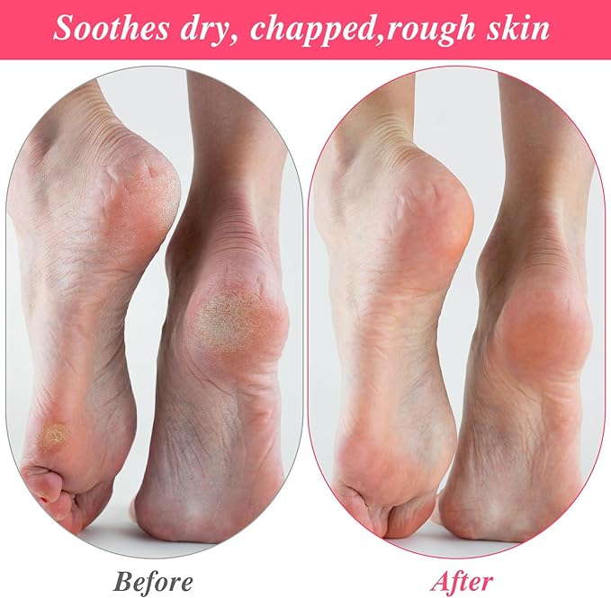 15Pairs Moisturizing Socks Overnight, Cotton Moisture Enhancing Socks, Spa Sock for Cracked Heel Repair, Spa Moisturizing Sock for Women and Men, White